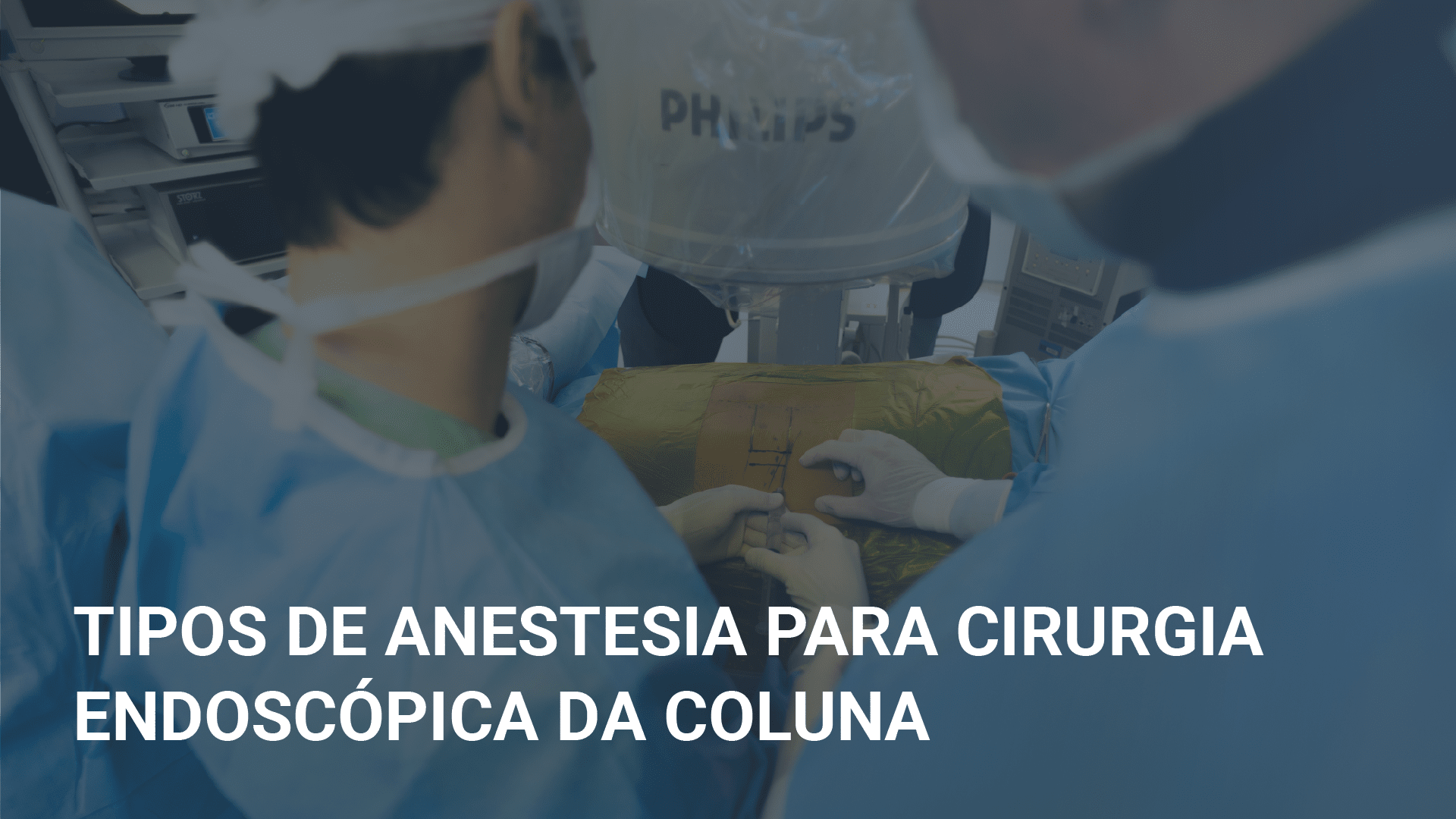 Tipos de anestesia para cirurgia endoscópica da coluna