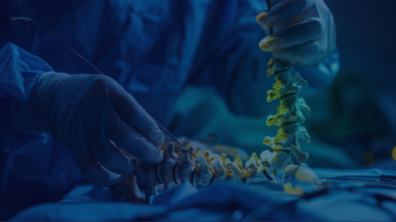 Cirurgia Endoscópica Transforaminal da Coluna: Indicações, Técnica e Resultados