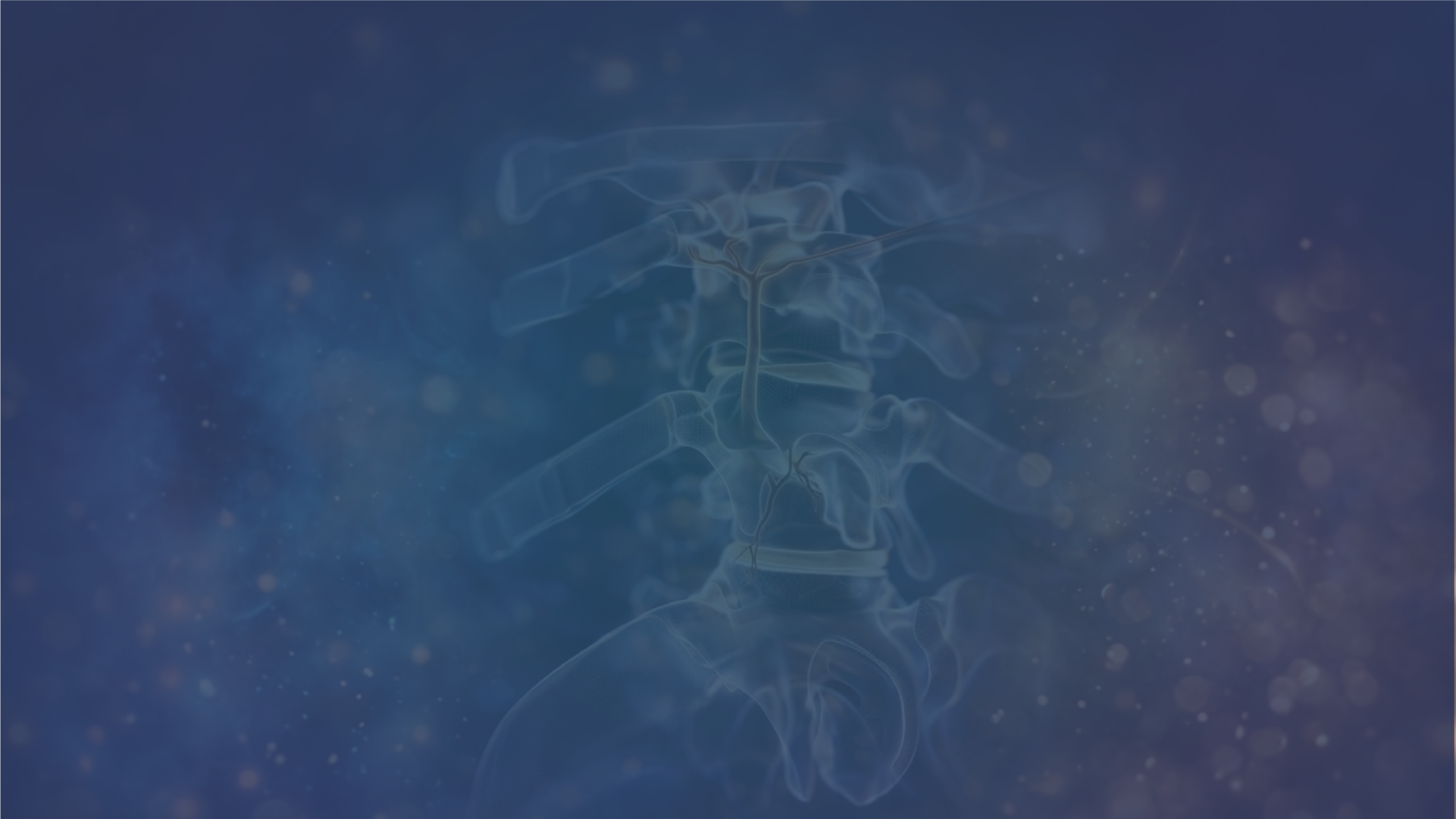 Estratégias para Hérnias de Disco Altamente Migradas: Abordagem Cranial e Caudal na Endoscopia da Coluna